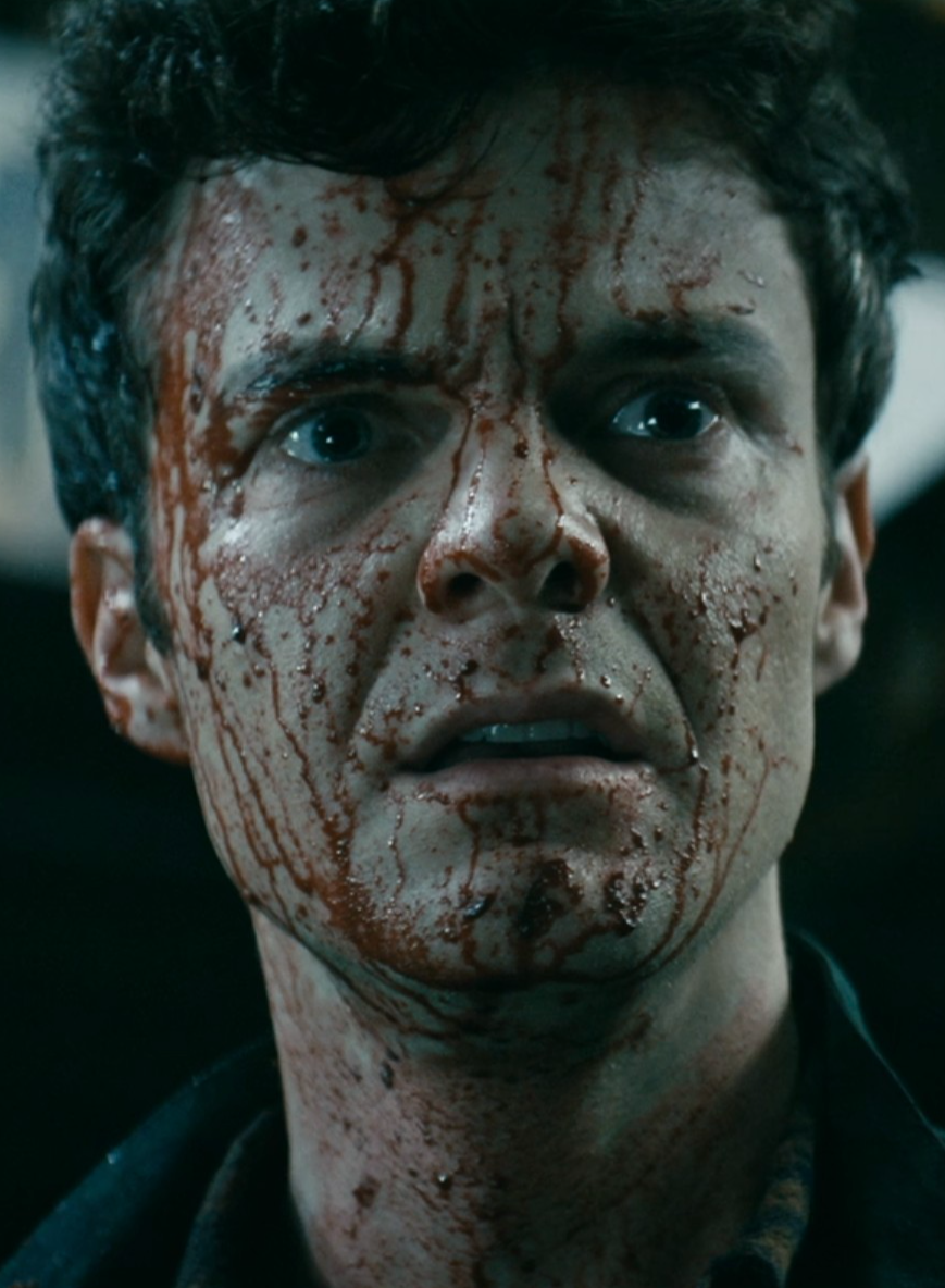 Hughie's bloody face.